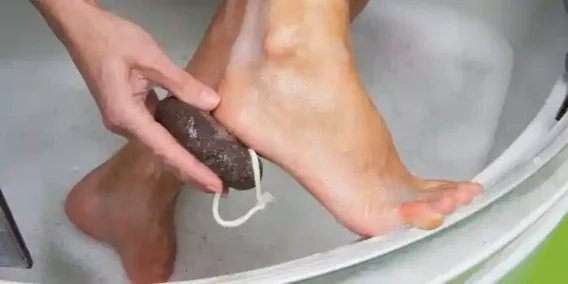 The image shows a close-up of a person using a pumice stone to scrub the heel of their foot. The foot is wet and appears to be in a basin filled with soapy water, suggesting that the person is performing a foot care routine, likely to remove dead skin or calluses. The pumice stone is dark in color and has a white string attached to it. This image is relevant as it depicts a common personal hygiene practice.